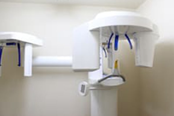 歯科用CTを活用したインプラント治療