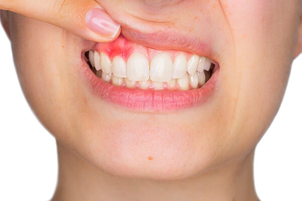 お口の健康を守ります～歯周病治療・予防歯科～