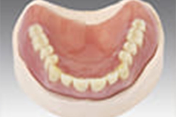 レジン床義歯（保険診療の入れ歯）