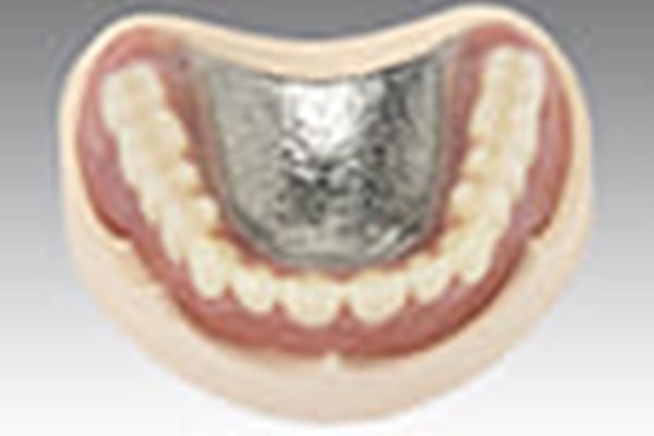 金属床義歯（自費診療の入れ歯）