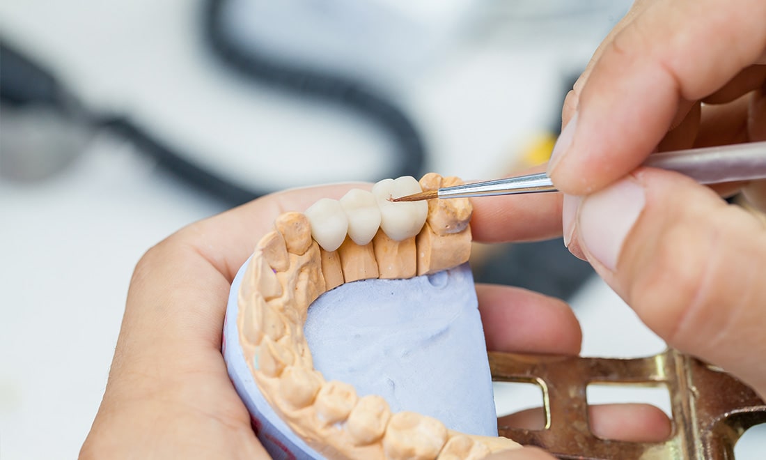 優秀な歯科技工士と歯科医師の連携